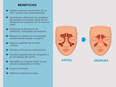 Limpiador Nasar Irrigador Picos Bidcom