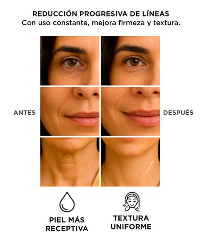 Masajeador Facial Radiofrecuencia Gadnic CPLED1 Rejuvenecedor - 4