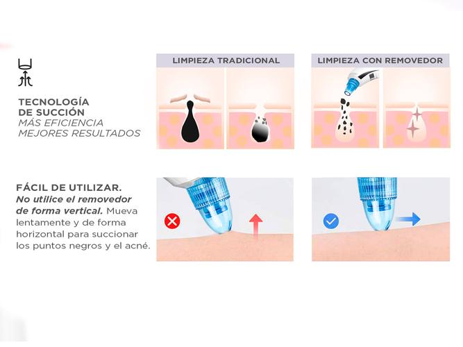 Limpiador Facial Care By Gadnic BF3078 Removedor de Puntos Negros 5 Velocidades Usado - 3