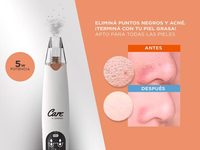 Limpiador Facial Removedor de Puntos Negros Gadnic Recargable  - 2