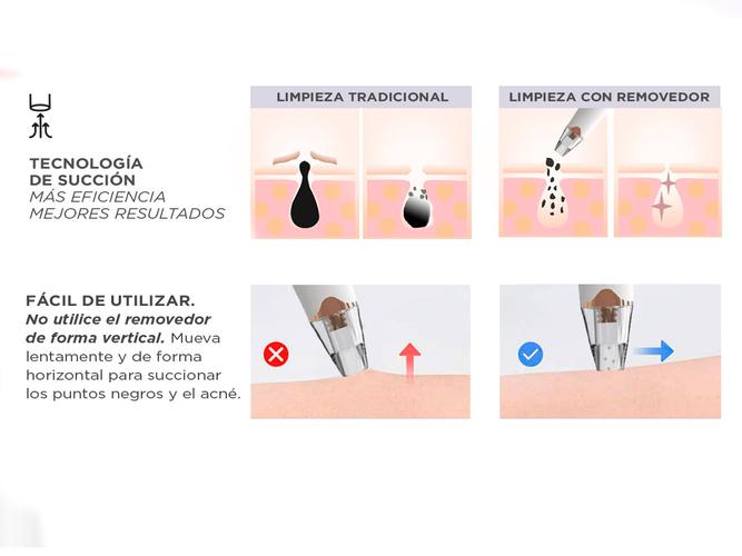Limpiador Facial Removedor de Puntos Negros Gadnic Recargable  - 4