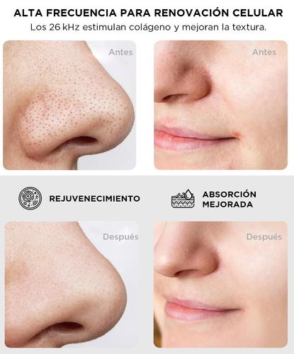 Espátula Facial Gadnic CL50 Ultrasónica  - 2