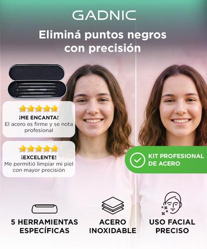 Extractor De Puntos Negros Gadnic KM600 Kit De 5 Agujas Acné  - 1