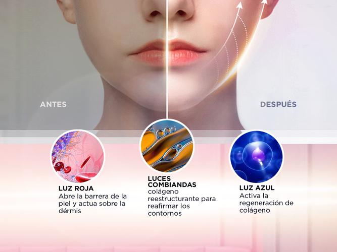 Mascara Facial de Electroestimulación Gadnic Reductora Lifting - 4