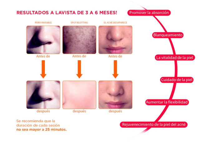 Mascara Facial Led Gadnic LT30 Terapia Acné Rejuvenecimiento  - 4