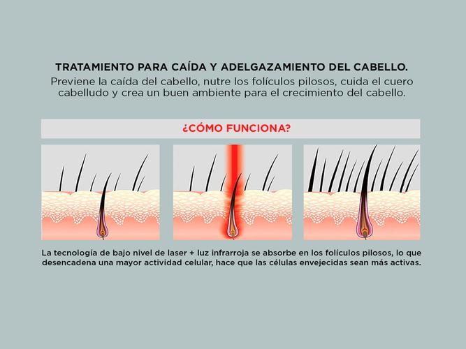 Casco Para El Crecimiento Del Cabello LESCOLTON D601 Con Infrarrojos Y Laser  Usado - 2
