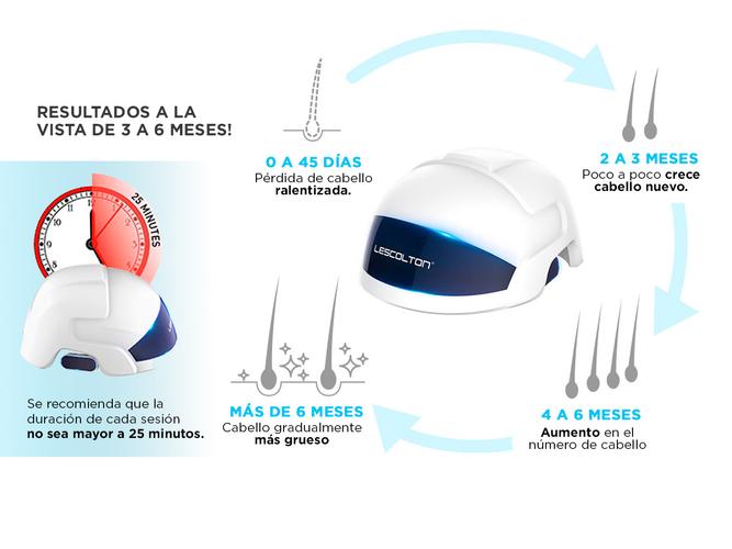 Casco Para El Crecimiento Del Cabello LESCOLTON D601 Con Infrarrojos Y Laser  Usado - 3