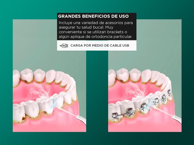Irrigador Bucal Dentales Limpiador Dientes De Agua Portátil - 3