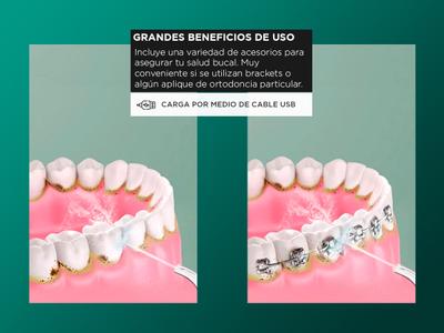 Irrigador Bucal Dentales Limpiador Dientes De Agua Portátil Gadnic